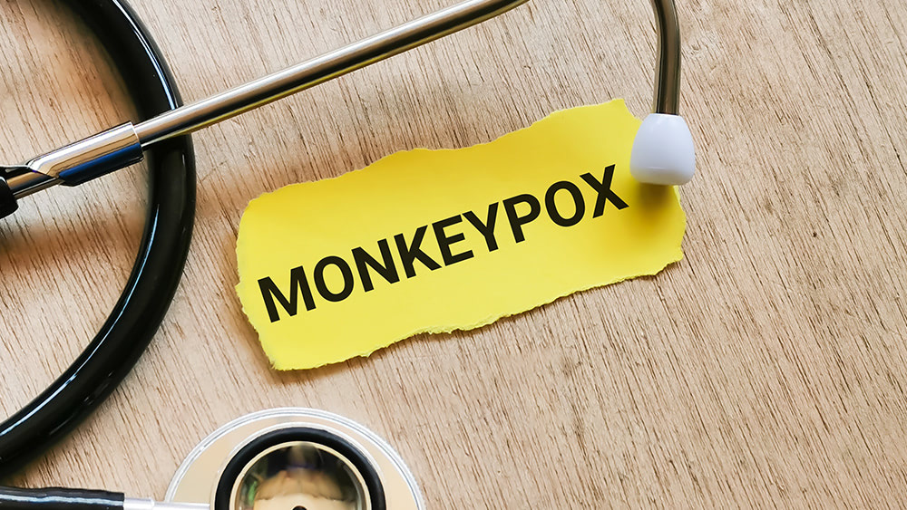 Monkeypox transmission could accelerate this summer, warns WHO… but is it just more fearmongering?