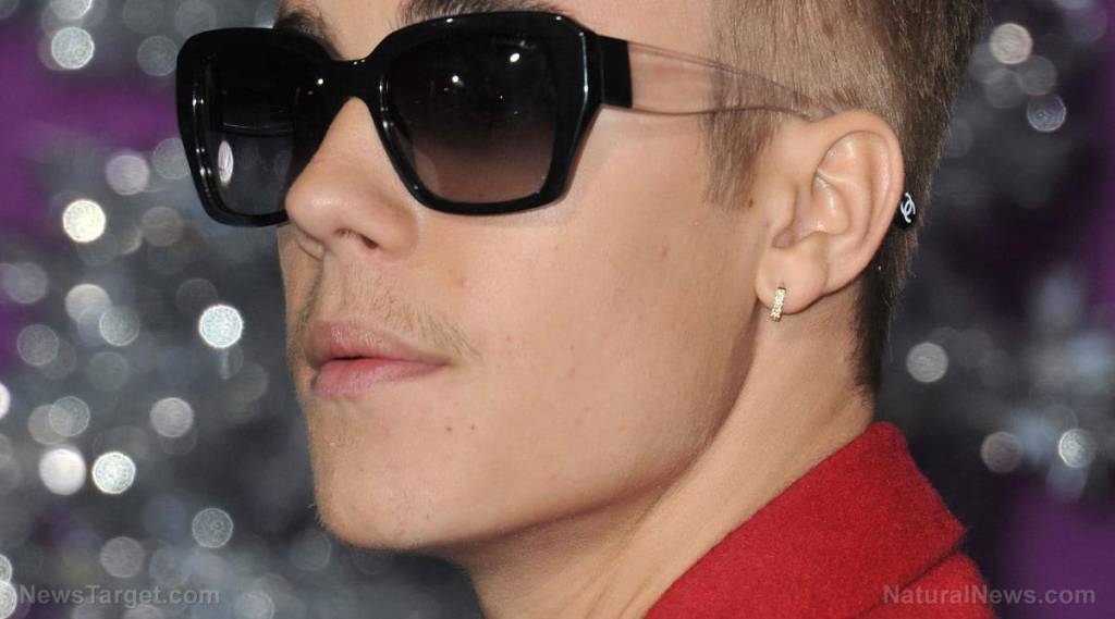 Justin Bieber’s face paralyzed with Ramsay Hunt syndrome, a known adverse reaction of covid injections